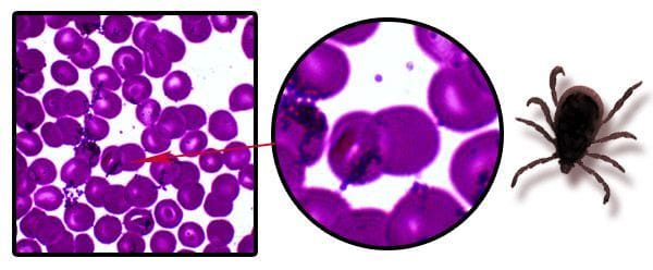 Imagen microscópica de Mycoplasma haemocanis de la sangre de Ronie